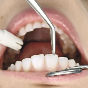 Cirurgia_Oral_especialidade