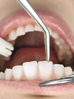 Cirurgia_Oral_especialidade